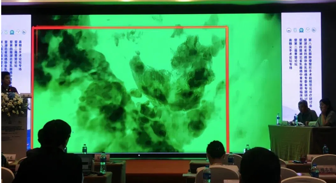 保乳手術(shù)和乳房重建術(shù)的最新強(qiáng)助力：術(shù)中手持顯微鏡EndoSCell?