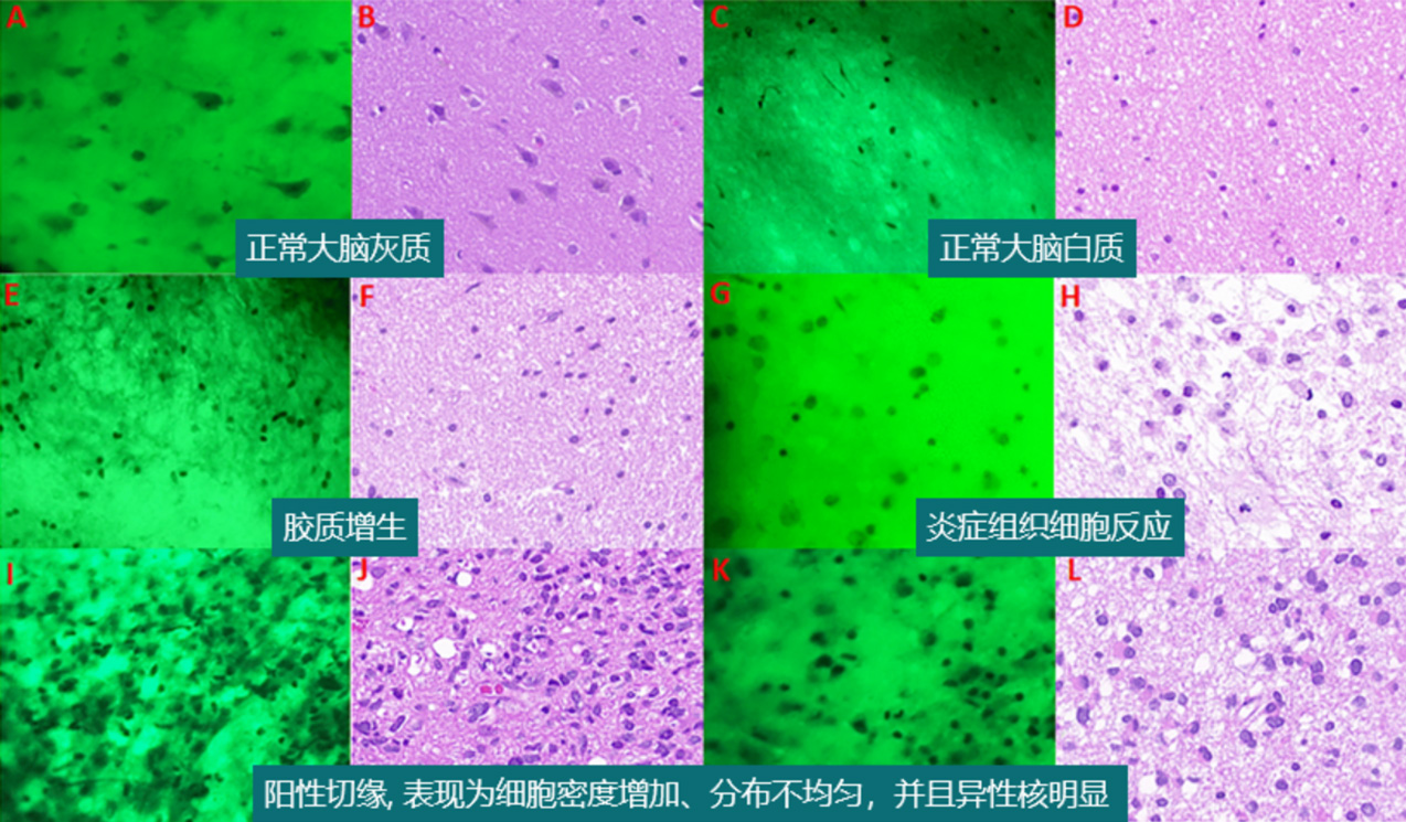 神經(jīng)外科(圖3) 神經(jīng)外科(圖3)