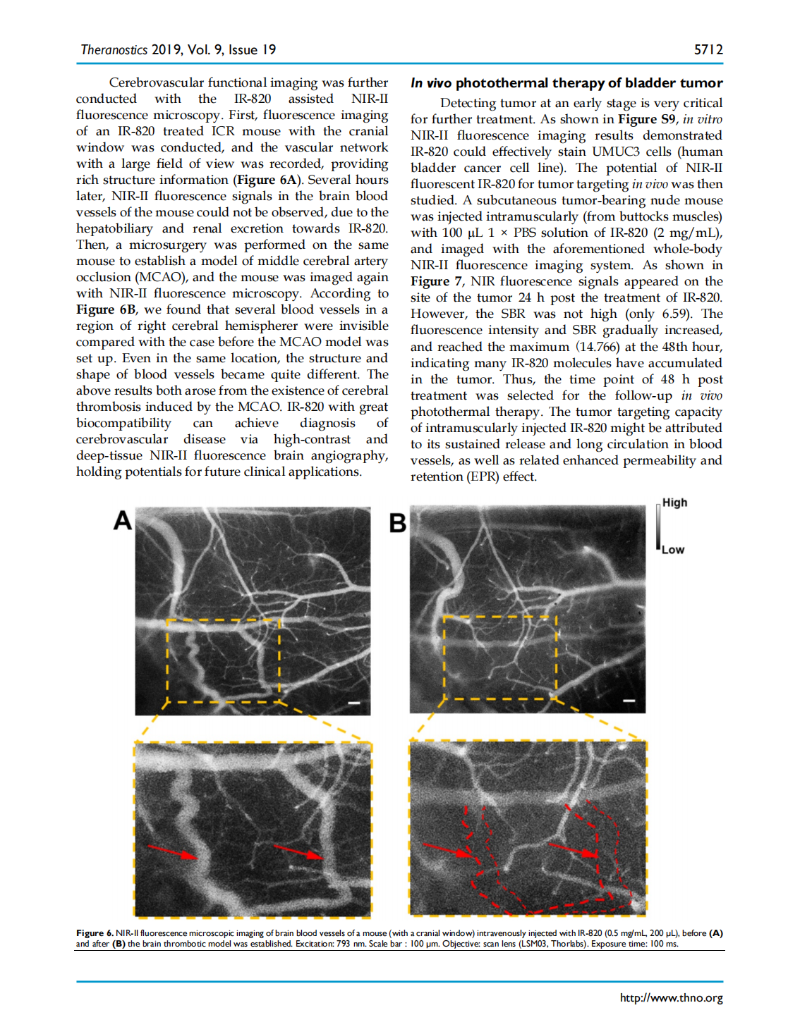 Excretable IR-820 for in vivo NIR-II fluorescence cerebrovascular imaging and photothermal therapy of subcutaneous tumor(圖7)