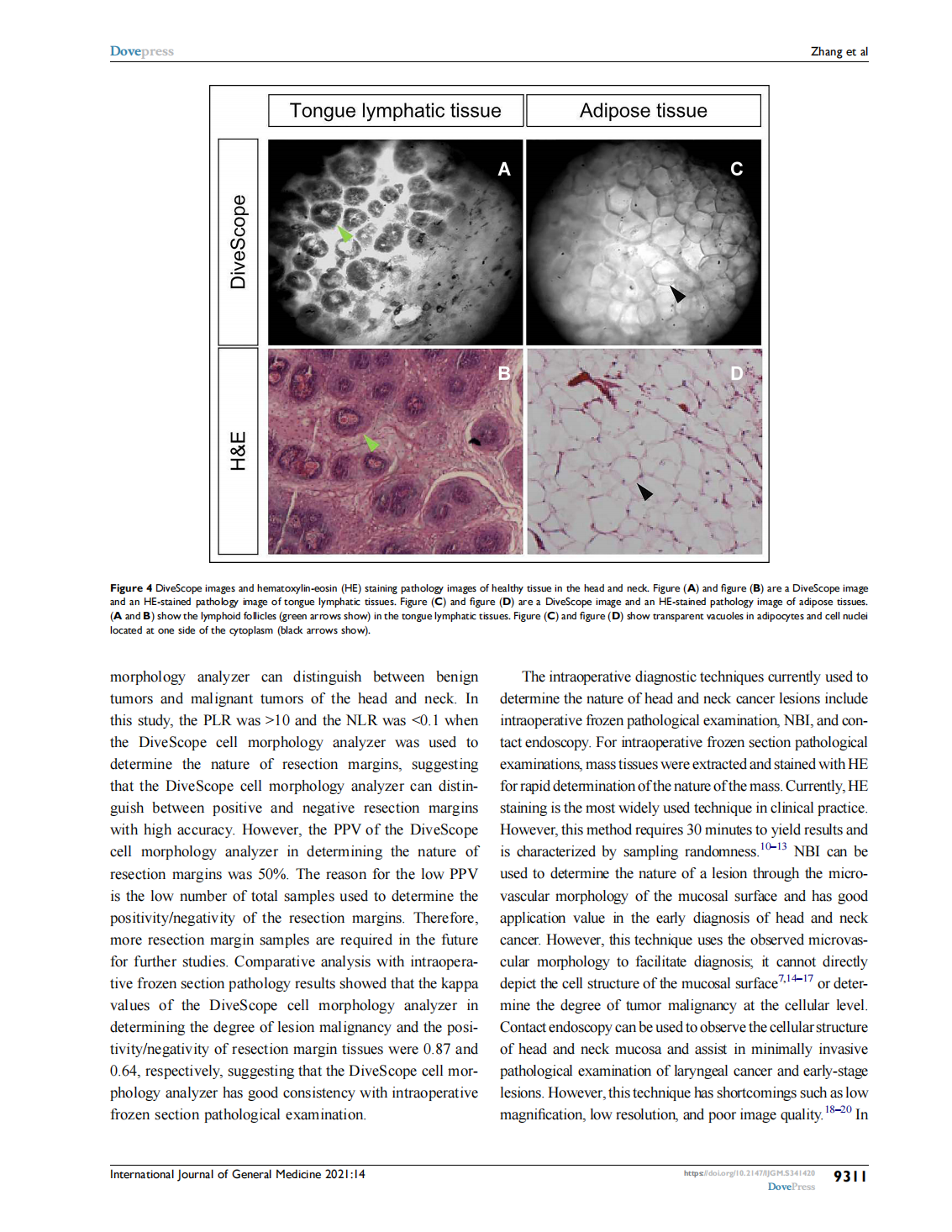 A Novel Cell Morphology Analyzer Application in  Head and Neck Cancer(圖5)