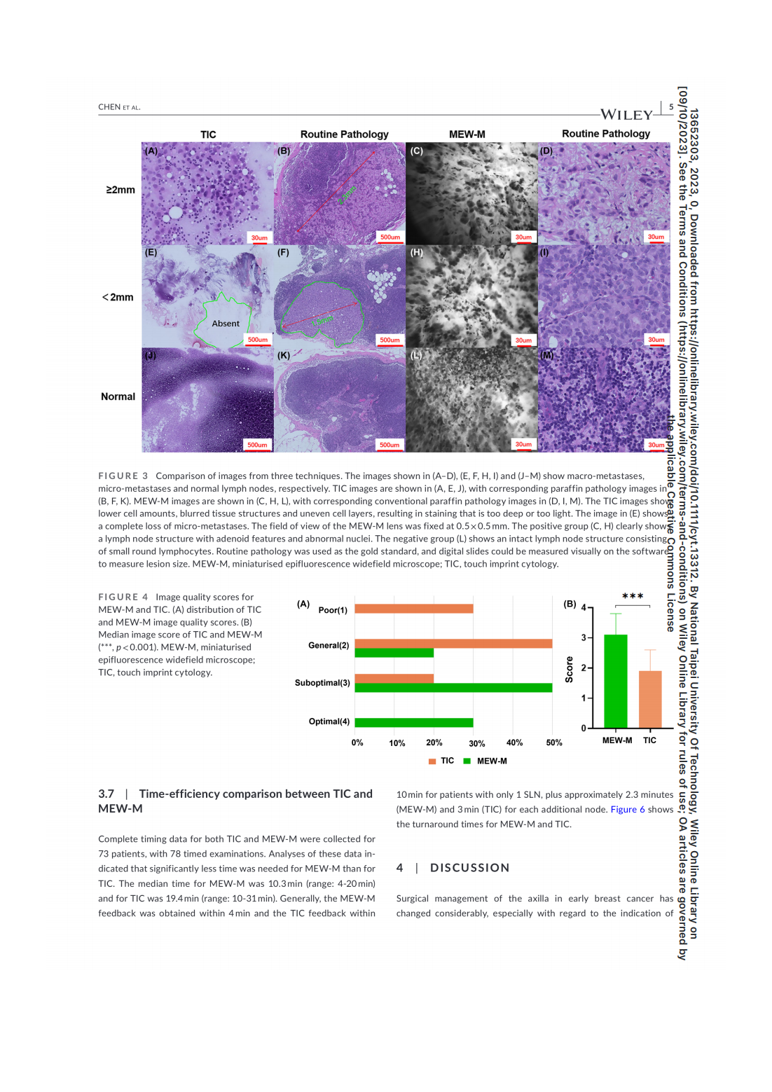【Cytopathology 2023】-乳腺癌_04.png A prospective comparison of a modified miniaturised hand-held epifluorescence microscope and touch imprint cytologyfor evaluation of axillary sentinel lymph nodes intraoperativelyin breast cancer pati(圖5)