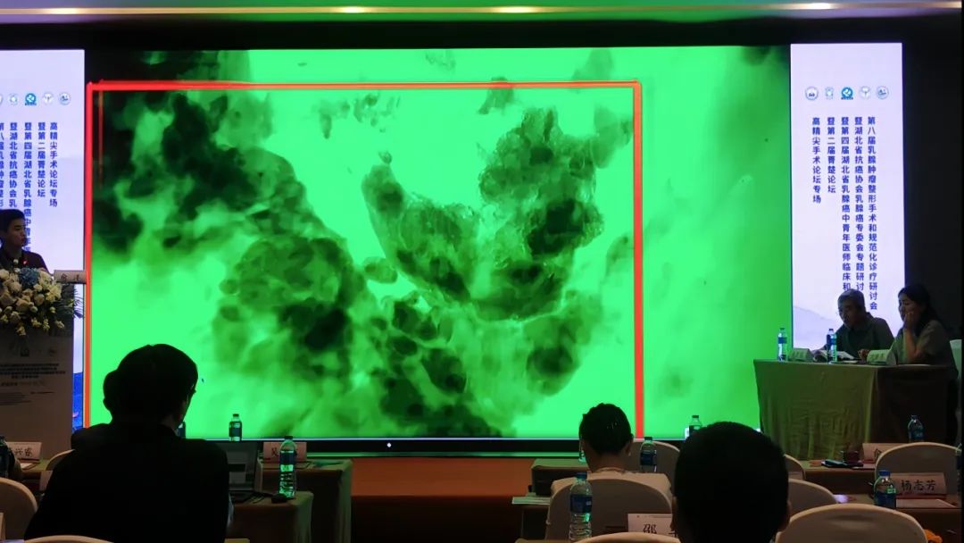 保乳手術和乳房重建術的最新強助力:術中手持顯微鏡EndoSCell?(圖7)