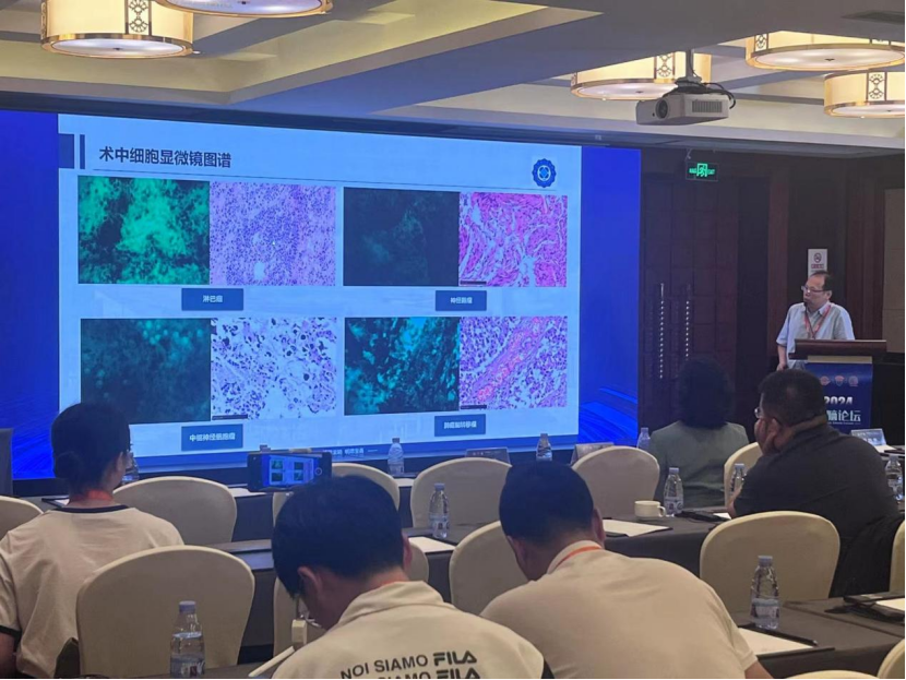 “細胞眼”助力精準手術(shù):術(shù)中手持顯微鏡EndoSCell?成2024年人腦論壇亮點(圖5)
