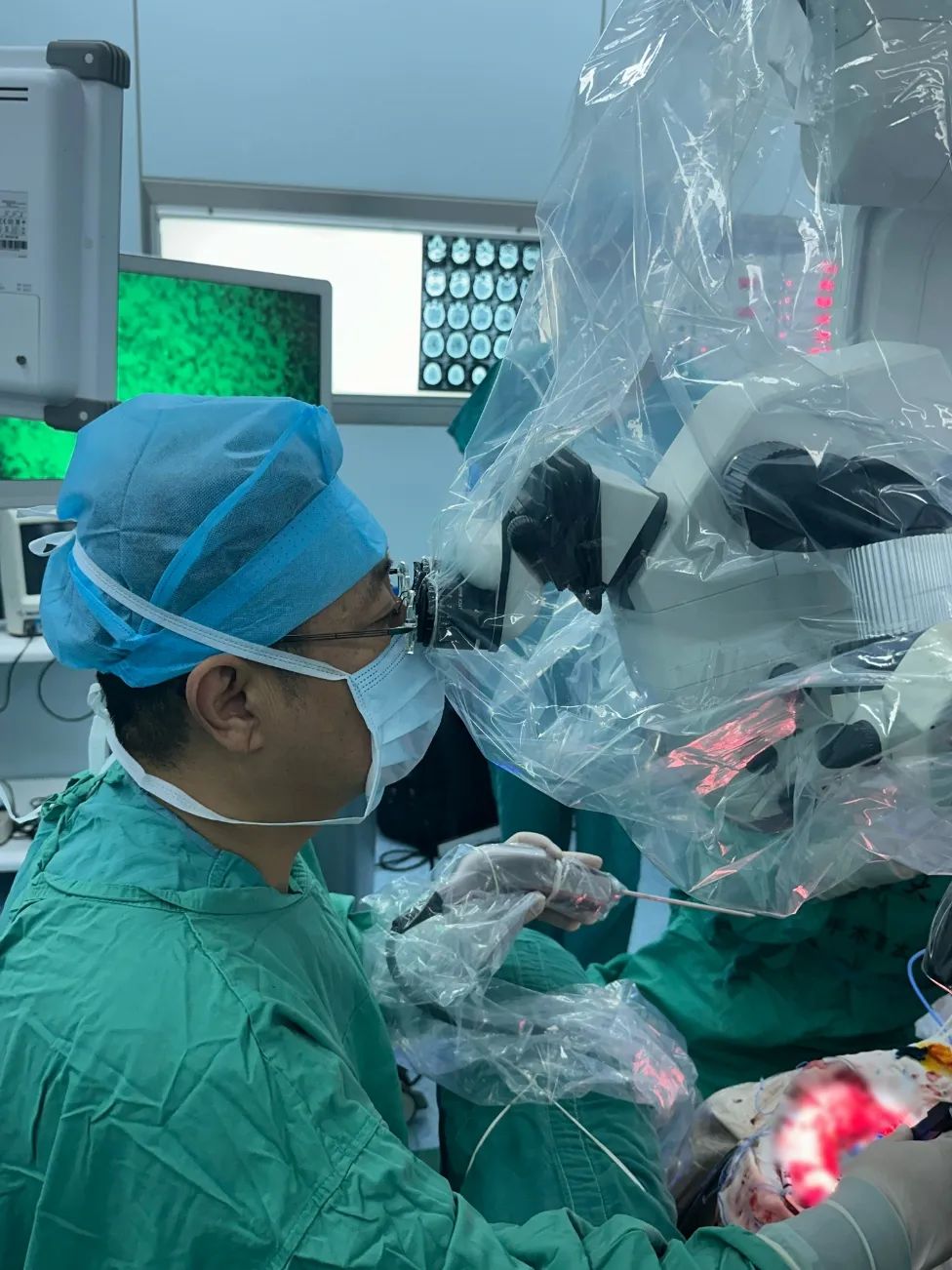 河北醫(yī)大二院應(yīng)用細(xì)胞級(jí)熒光導(dǎo)引精準(zhǔn)技術(shù)，突破高級(jí)別膠質(zhì)瘤手術(shù)的裸眼限制(圖7)