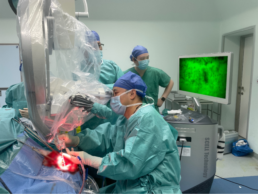 齊魯醫(yī)院開啟精準(zhǔn)手術(shù)新篇章，細(xì)胞級熒光導(dǎo)引技術(shù)助力腦膠質(zhì)瘤最大化安全切除(圖4)