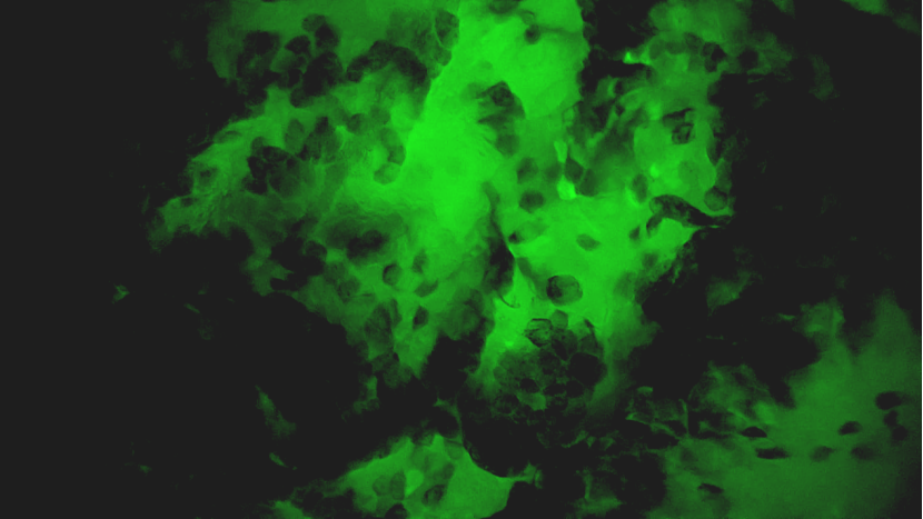 甲狀腺癌細(xì)胞級精準(zhǔn)手術(shù)即將實(shí)現(xiàn)！河北省人民醫(yī)院引入細(xì)胞級熒光導(dǎo)引技術(shù)(圖3)