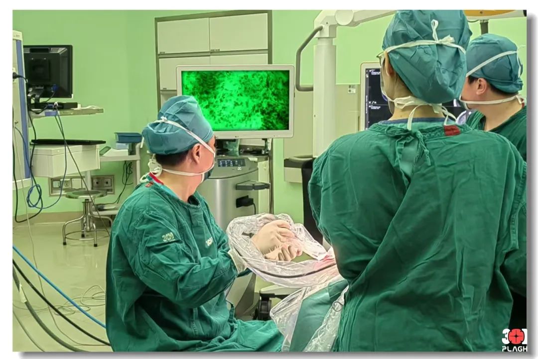 解放軍總醫(yī)院第一醫(yī)學(xué)中心神經(jīng)外科醫(yī)學(xué)部成功應(yīng)用EndoSCell?精準(zhǔn)切除腦膠質(zhì)瘤(圖5)