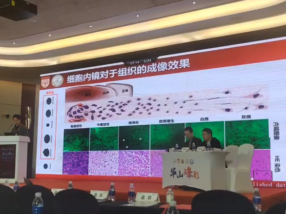 第三屆“華山峰彩”學(xué)術(shù)論壇盛大召開(kāi):專家共話細(xì)胞內(nèi)鏡EndoSCell?細(xì)胞級(jí)精準(zhǔn)手術(shù)方案(圖3)