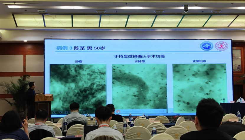 昆明神經(jīng)腫瘤論壇:EndoSCell?細(xì)胞級熒光導(dǎo)引技術(shù)開啟精準(zhǔn)手術(shù)新時代(圖5)