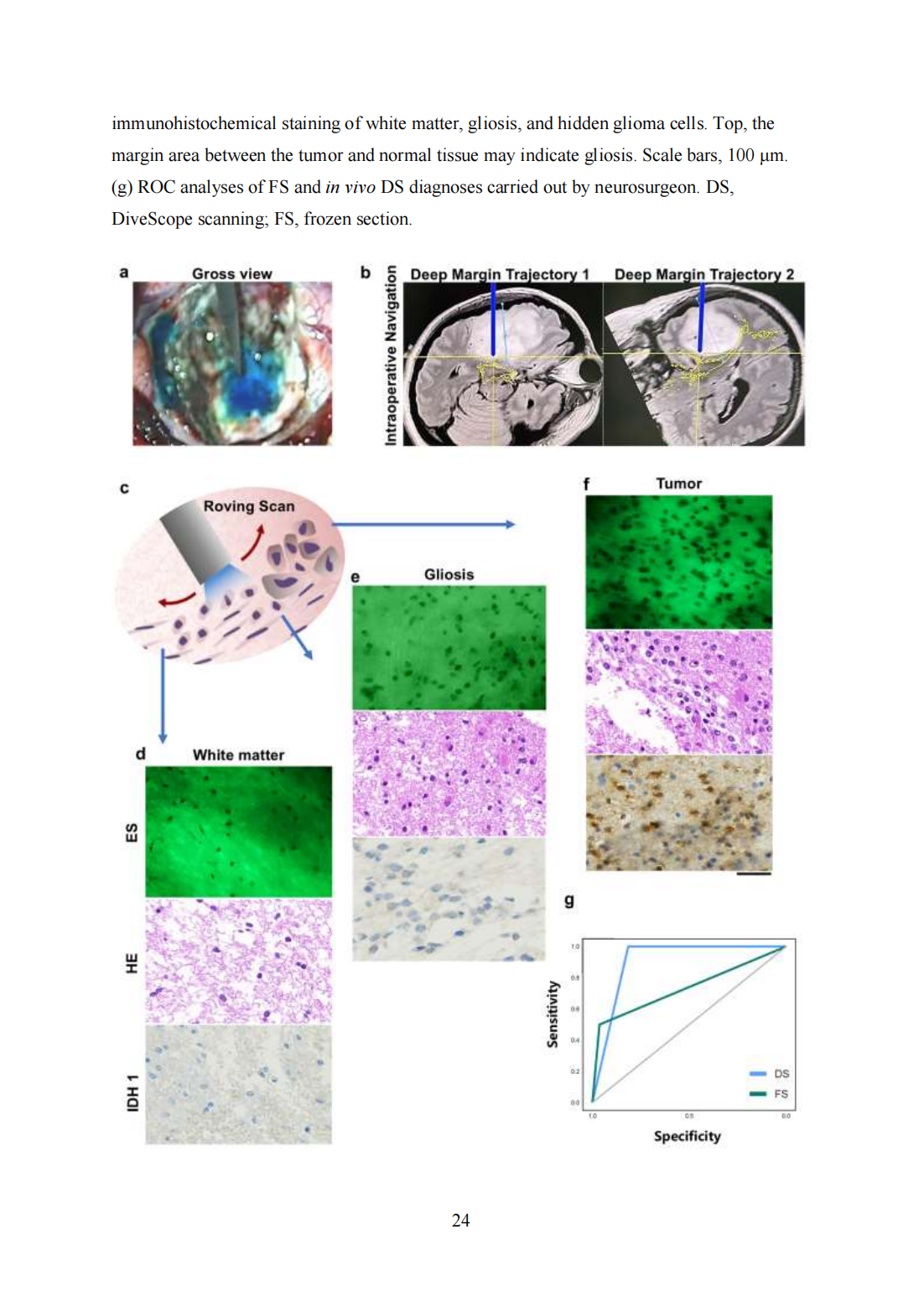 Roving histological imaging for navigation-confirmed glioma negative margin by handheld endomicroscopy: a parallel controlled study(圖24)