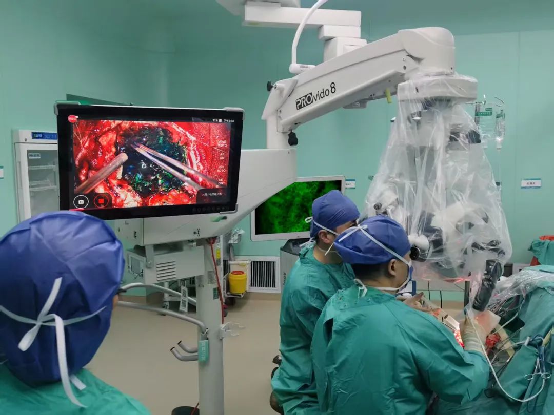 腦惡性腫瘤手術(shù)治療新進(jìn)展！邢臺(tái)市人民醫(yī)院應(yīng)用術(shù)中細(xì)胞級(jí)熒光導(dǎo)引技術(shù)最大化安全切除腦膠質(zhì)瘤(圖2)