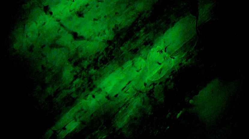 甲狀腺癌手術(shù)新突破！河北省人民醫(yī)院成功應(yīng)用細胞級熒光導引技術(shù)實現(xiàn)精準切除與保功能(圖4)