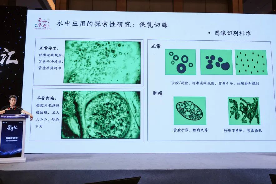 細(xì)胞級熒光導(dǎo)引技術(shù)亮相沈陽乳腺癌論壇，EndoSCell?破解術(shù)中切緣判讀難題(圖6)