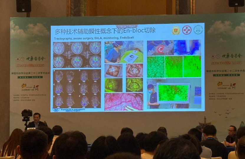 中華醫(yī)學(xué)會神經(jīng)外科學(xué)分會第二十二次學(xué)術(shù)會議在蘇召開:細(xì)胞級熒光導(dǎo)引技術(shù)引領(lǐng)神經(jīng)外科手術(shù)邁入精準(zhǔn)可視化新時代(圖9)